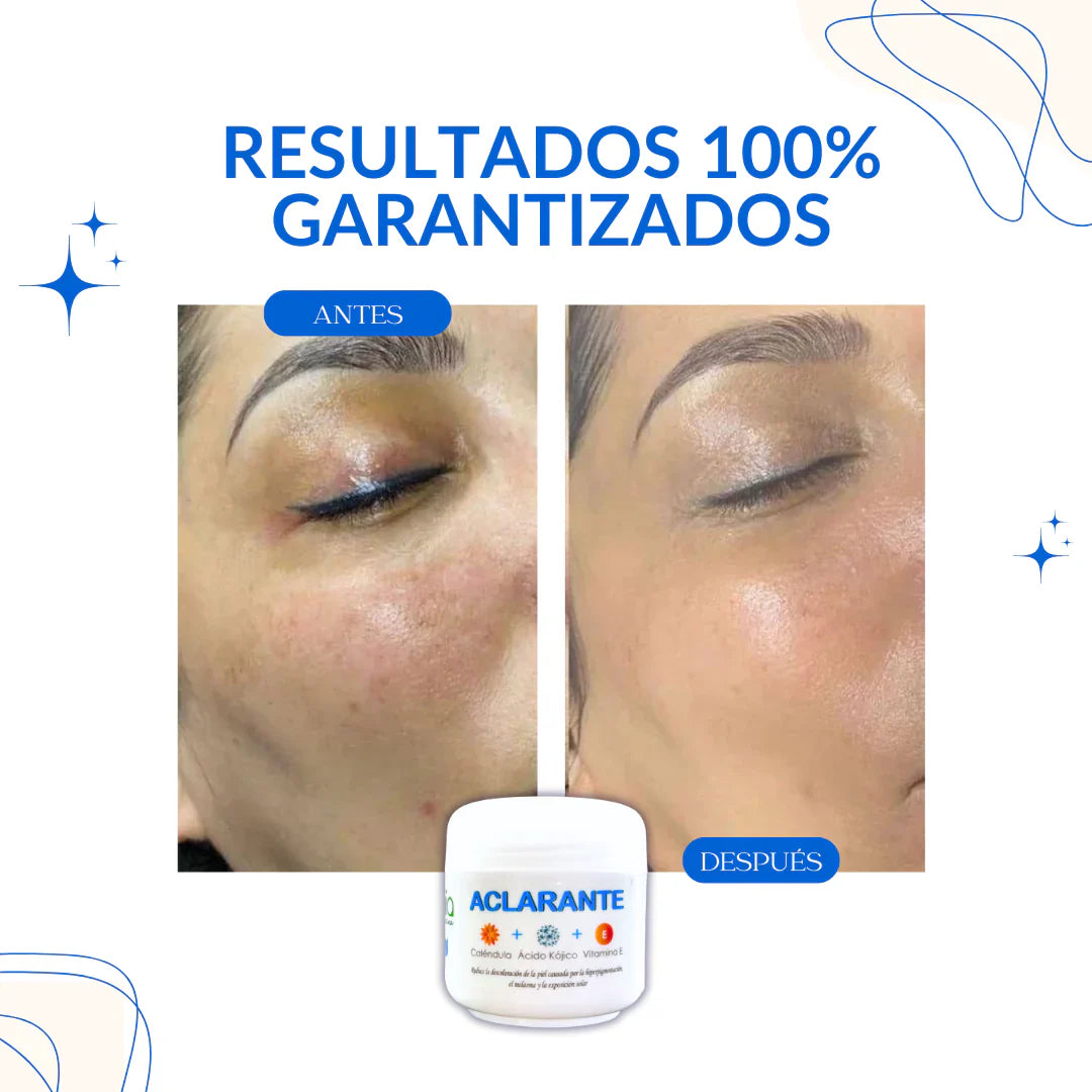 crema aclarante